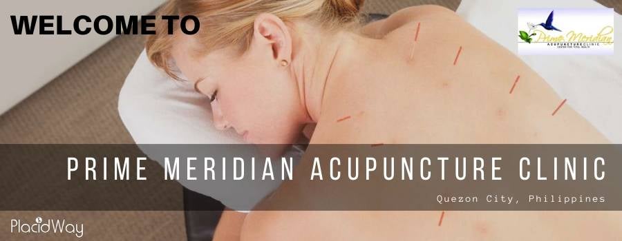 Acupuncture in Philipppines Acupuncture in Philipppines